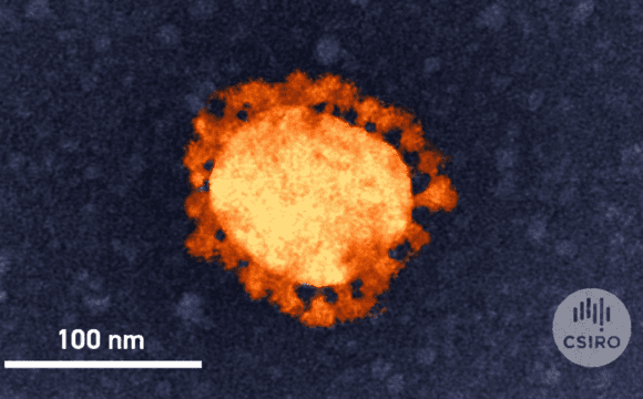 A miscroscopic image of the SARS coronavirus 2