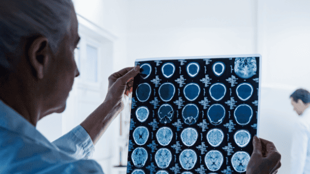 A medical professional inspecting a scan of a human brain