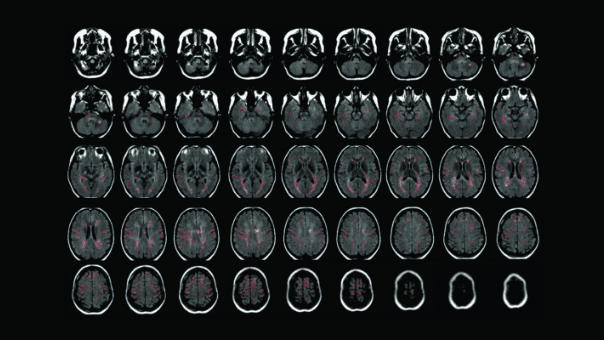 An array of scans of a human brain